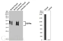 Anti-CD79a antibody [HL5600] used in Western Blot (WB). GTX646282