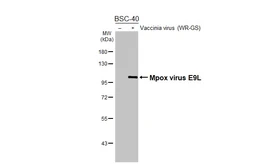 Anti-Mpox virus E9L antibody [HL5618] used in Western Blot (WB). GTX646300