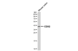 Anti-CDX2 antibody [HL5637] used in Western Blot (WB). GTX646326
