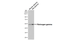 Anti-Fibrinogen gamma antibody [HL5648] used in Western Blot (WB). GTX646457