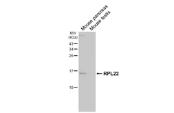 Anti-RPL22 antibody [HL5683] used in Western Blot (WB). GTX646492