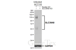 Anti-SLC39A8 antibody [HL5690] used in Western Blot (WB). GTX646521