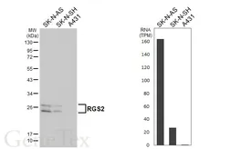 Anti-RGS2 antibody [HL5699] used in Western Blot (WB). GTX646530