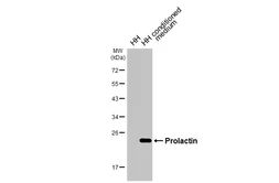 Anti-Prolactin antibody [HL5727] used in Western Blot (WB). GTX646678