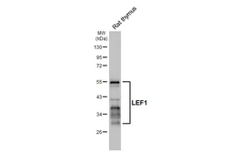 Anti-LEF1 antibody [HL5729] used in Western Blot (WB). GTX646680
