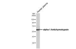 Anti-alpha 1 Antichymotrypsin antibody [HL5762] used in Western Blot (WB). GTX646713