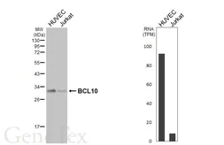 Anti-BCL10 antibody [HL5765] used in Western Blot (WB). GTX646716