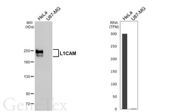 Anti-L1CAM antibody [HL5786] used in Western Blot (WB). GTX646857