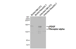 Anti-PDGF Receptor alpha antibody [HL5791] used in Western Blot (WB). GTX646862