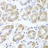 Anti-ACP1 antibody used in IHC (Paraffin sections) (IHC-P). GTX64698