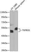 Anti-HIC5 antibody used in Western Blot (WB). GTX64707