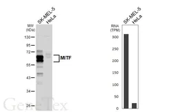 Anti-MITF antibody [HL5838] used in Western Blot (WB). GTX647156