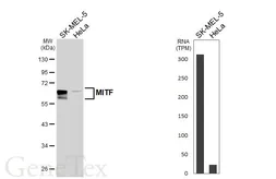 Anti-MITF antibody [HL5839] used in Western Blot (WB). GTX647157