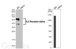 Anti-IL2 Receptor alpha antibody [HL5840] used in Western Blot (WB). GTX647158