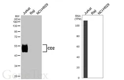 Anti-CD2 antibody [HL5861] used in Western Blot (WB). GTX647185