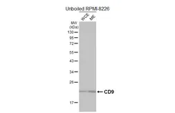 Anti-CD9 antibody [HL5881] used in Western Blot (WB). GTX647205