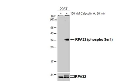 Anti-RPA32 (phospho Ser4) antibody [HL5883] used in Western Blot (WB). GTX647207