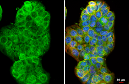 Anti-c-Met antibody [HL5898] used in Immunocytochemistry/ Immunofluorescence (ICC/IF). GTX647222