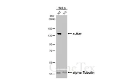 Anti-c-Met antibody [HL5899] used in Western Blot (WB). GTX647223