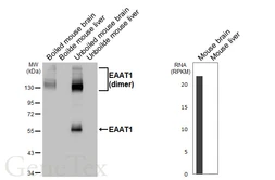 Anti-EAAT1 antibody [HL5912] used in Western Blot (WB). GTX647237