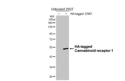 Anti-Cannabinoid receptor 1 antibody [HL5924] used in Western Blot (WB). GTX647249