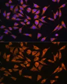Anti-PMM2 antibody used in Immunocytochemistry/ Immunofluorescence (ICC/IF). GTX64726
