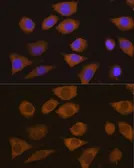 Anti-CSDE1 antibody used in Immunocytochemistry/ Immunofluorescence (ICC/IF). GTX64731