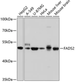 Anti-FADS2 antibody used in Western Blot (WB). GTX64748