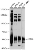 Anti-PEG10 antibody used in Western Blot (WB). GTX64752
