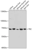 Anti-Tec antibody used in Western Blot (WB). GTX64753