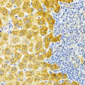 Anti-EDA antibody used in IHC (Paraffin sections) (IHC-P). GTX64760