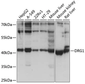 Anti-DRG1 antibody used in Western Blot (WB). GTX64763
