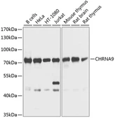 Anti-AChR alpha 9 antibody used in Western Blot (WB). GTX64774