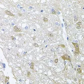 Anti-Rapsyn antibody used in IHC (Paraffin sections) (IHC-P). GTX64777