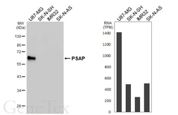 Anti-PSAP antibody [HL6041] used in Western Blot (WB). GTX648120