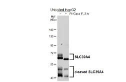 Anti-SLC39A4 antibody [HL6051] used in Western Blot (WB). GTX648130