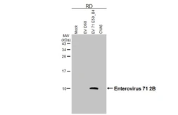Anti-Enterovirus 71 2B antibody [HL6053] used in Western Blot (WB). GTX648132