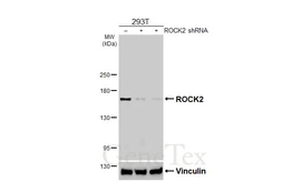 Anti-ROCK2 antibody [HL6078] used in Western Blot (WB). GTX648157