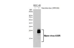 Anti-Mpox virus A35R antibody [GT402] used in Western Blot (WB). GTX648167