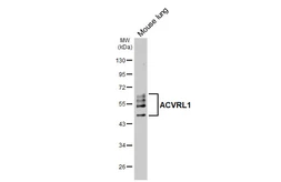 Anti-ACVRL1 antibody [HL6091] used in Western Blot (WB). GTX648176