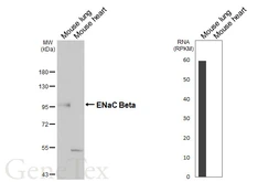 Anti-ENaC Beta antibody [HL6092] used in Western Blot (WB). GTX648177