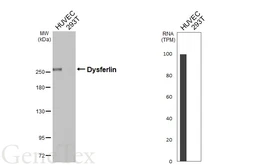 Anti-Dysferlin antibody [HL6123] used in Western Blot (WB). GTX648208