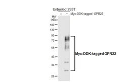 Anti-GPR22 antibody [HL6134] used in Western Blot (WB). GTX648221