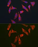 Anti-MYO10 antibody used in Immunocytochemistry/ Immunofluorescence (ICC/IF). GTX64824