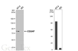 Anti-CD2AP antibody [HL6173] used in Western Blot (WB). GTX648260