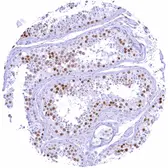 Anti-Rad51 antibody [HMV4727] HistoMAX&trade; used in IHC (Paraffin sections) (IHC-P). GTX648264
