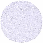 Anti-Claudin 18.2 antibody [HMV4729] HistoMAX&trade; used in IHC (Paraffin sections) (IHC-P). GTX648266