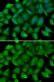 Anti-Defensin alpha 1 antibody used in Immunocytochemistry/ Immunofluorescence (ICC/IF). GTX64827