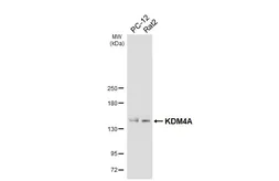 Anti-KDM4A antibody [HL6181] used in Western Blot (WB). GTX648273