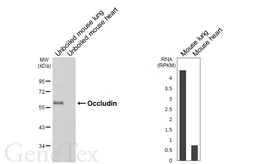 Anti-Occludin antibody [HL6239] used in Western Blot (WB). GTX648331